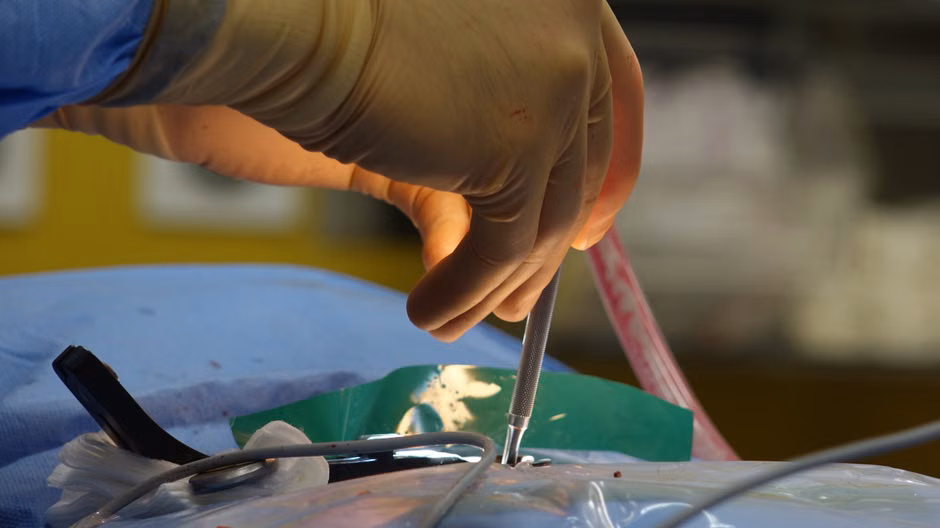 Detailed view of a surgical operation, highlighting precision medical tools in use.