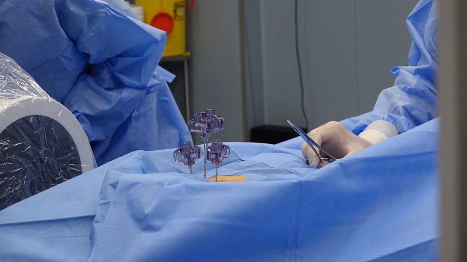 A surgeon wearing sterile gloves performs a delicate procedure in a modern operating room.